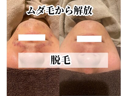 サロンステラ(SALON STELLA)の写真