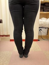 レフア 上北沢整体院/O脚・X脚改善