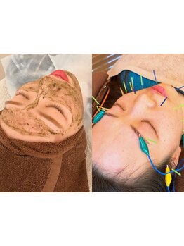 鍼灸施術を受けたい