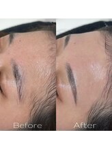 ビビ(BIBI)/おでこWAXとHBL