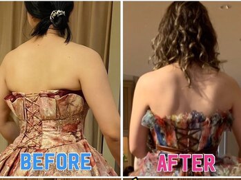 エステティックサロン ピュール ボーテ 東金店/ハイパーナイフ