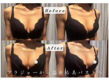 エステティックサロン パヒューム(Esthetic Salon Perfume)/1回で8割の方が変化を実感★