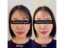 チアアップ 練馬(Cheer up)