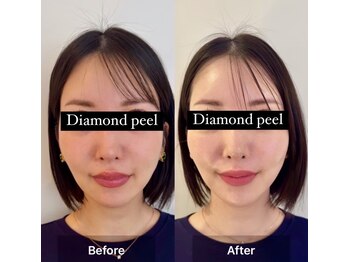 チアアップ 練馬(Cheer up)