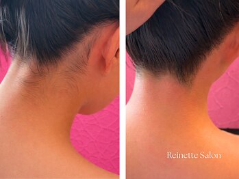 レネットサロン(Reinette Salon)/うなじワックス×光トリプル脱毛