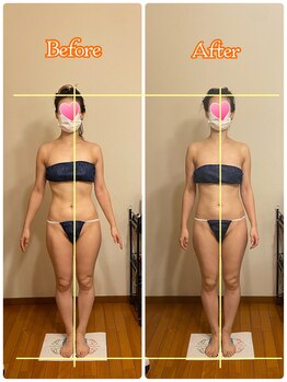 トータルボディセラピーハート(Heart)/真っ直ぐ立ったのに傾いている