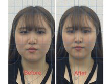 日進町整体院/20代女性　初回施術