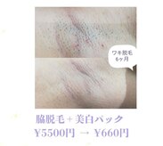 RiとBiのたまご
