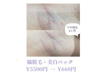 RiとBiのたまごの写真