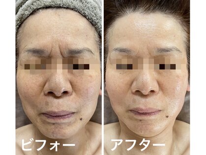 ナオフクオカ ヒーリングフォースエヌ(NaoFukuoka/healingforceN)の写真