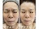 ナオフクオカ ヒーリングフォースエヌ(NaoFukuoka/healingforceN)の写真