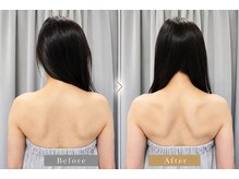 リバティ 世田谷代田整体院(Liberty)の雰囲気（《背中美人》首肩こりだけでなく、背中まで綺麗に◎）
