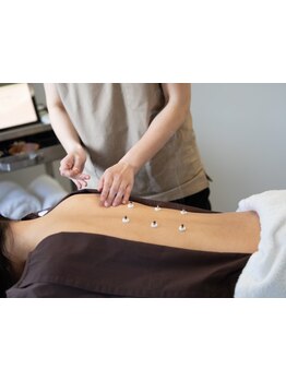 鍼灸施術を受けたい