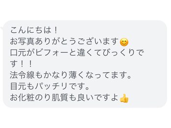 ホープ鍼灸整骨院/リアルな声です！