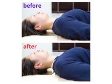 ゆずりは鍼灸整骨院/*整体×骨格矯正*施術前後*