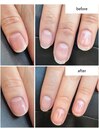 ハンドネイルケア