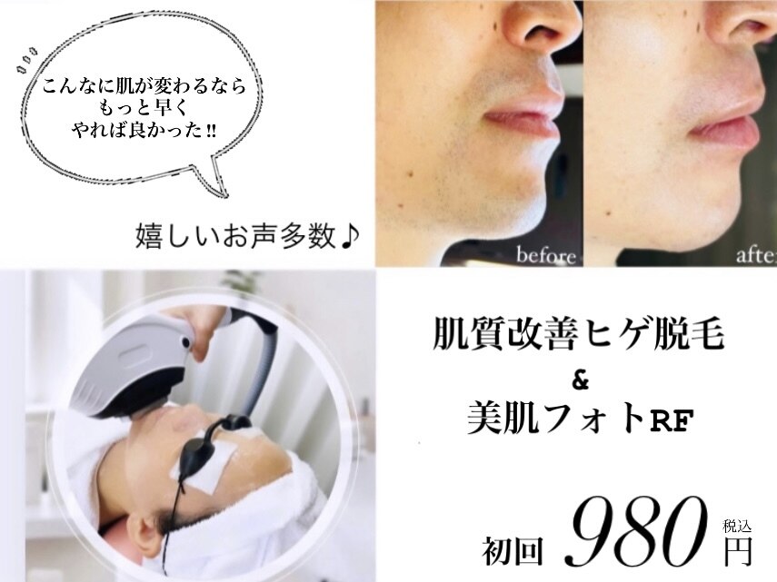 名古屋市天白区で光フェイシャルが人気のエステサロン｜ホットペッパー