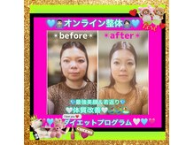 美容整体サロン ミキエ(Mikie)