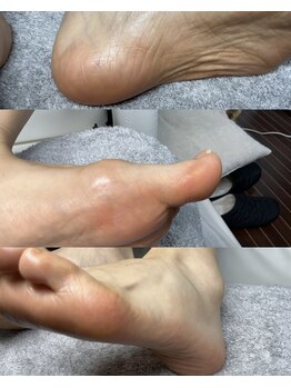 ルミエールサント(lumiere sainte)/足裏角質&タコ集中ケアコース