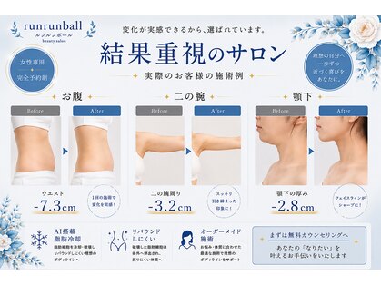 ルンルンボール(runrunball)の写真