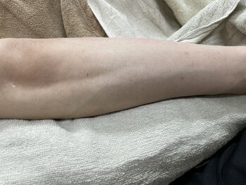 ナノハナ/鹿沼市の全身脱毛美容室ナノハナ