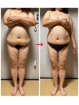 ユウウミ 北谷店(You海)/ウルトランスフォーマー　3ヵ月