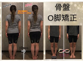 プルーム 大橋店(plume)/骨盤/O脚矯正