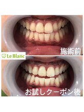 ルブラン 奈良店(Le Blanc)/白くしたい方！！