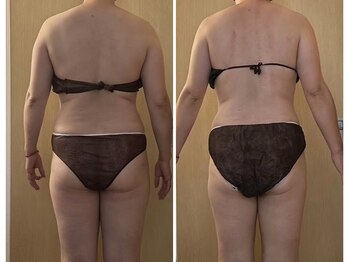 マイティー整骨院 ココア(CoCoa)/セルクラ