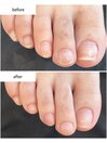 フットネイルケア