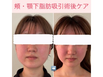 ミル(miru)の写真
