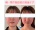 ミル(miru)の写真