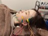 電気を流す美容鍼