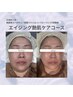 【大人気エイジングケア◎】エイジング艶肌ケアコース