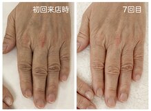 キレイテ 福岡天神店