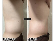 カピリナ(Kapilina)/ WINBACK90 2回【30代前半男性】