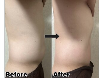 カピリナ(Kapilina)/ WINBACK90 2回【30代前半男性】