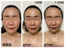 ダルセーニョ/「輪郭」が変わる理由！