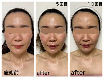 ダルセーニョ/「輪郭」が変わる理由！