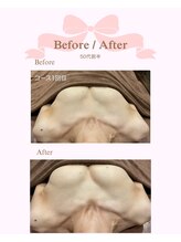 ロココ 安城店(Rococo)/バストアップ症例