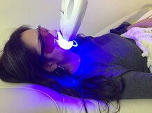 ティースクリーン(Teeth Clean)/ブライダル前にもおススメ！