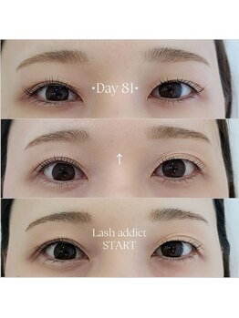 リアン(Lien)/ラッシュアディクトの効果!