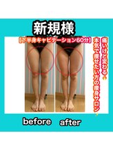 ビューティ ウィッチ(Beauty Witch)/