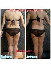 ラクラク(rakuraku)/痩身【全身】90分