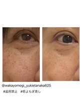 マロカ(Marroka)/【バラエティ蒸しの結果4】