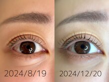 アンルル(EYE+anruru)/L3リフト