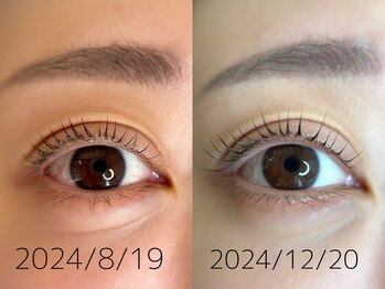 アンルル(EYE+anruru)/L3リフト