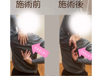 アイヲン(Aiwon)/【肩こり】【冷え】