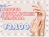 【両手指ダブル脱毛】シュガーワックス×コラーゲン光脱毛