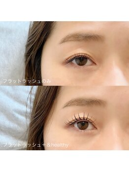 アイ ネイル スキン リリー(EYE NAIL SKIN Lily)/